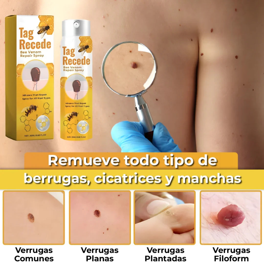 TAG RECEDE™ Eliminador de verrugas