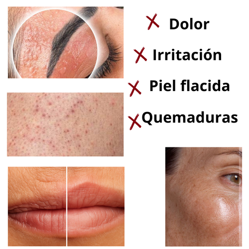 Depilación rápida, suave y sin dolor desde casa