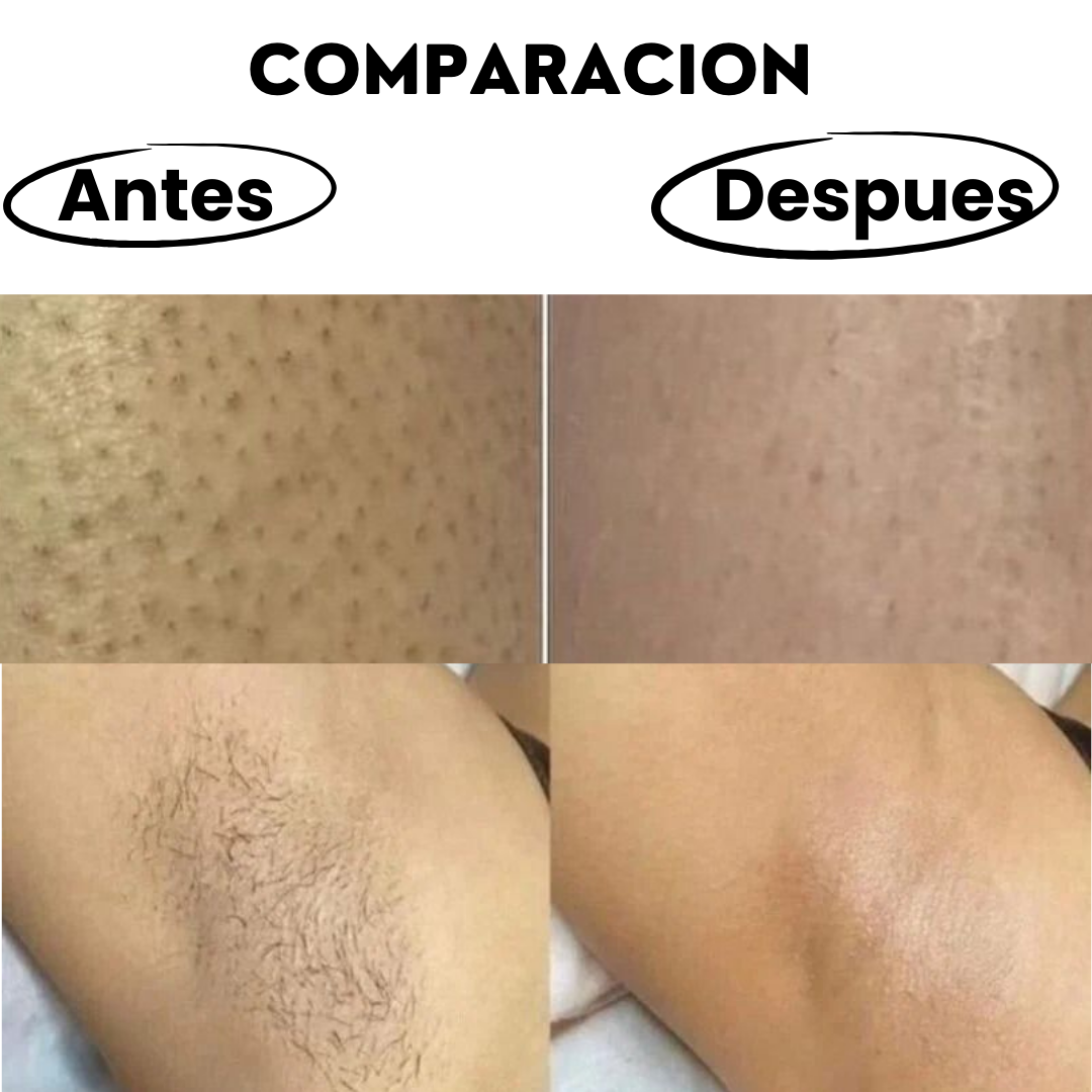 Depilación rápida, suave y sin dolor desde casa