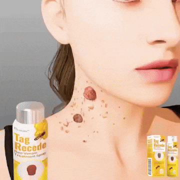 TAG RECEDE™ Eliminador de verrugas